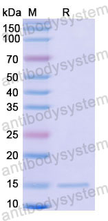 Валидация SDS-PAGE - AntibodySystem RHD68301