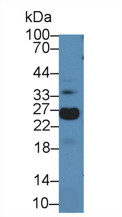 13954