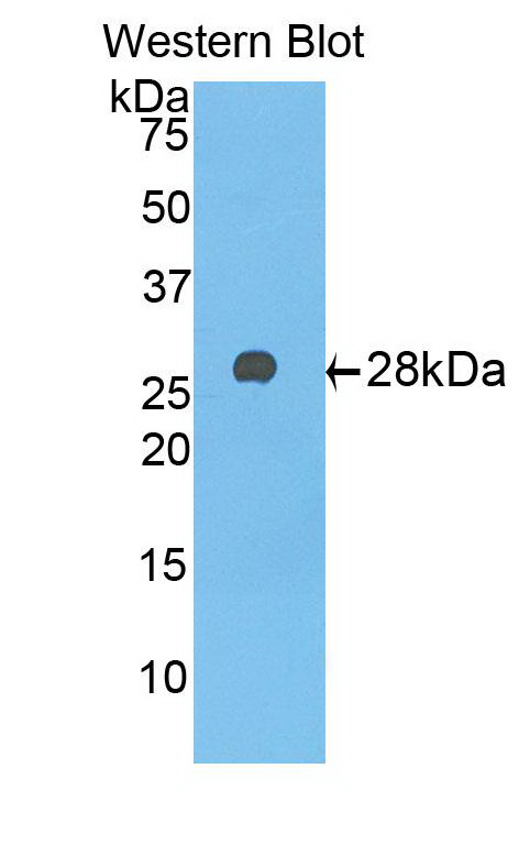 51125