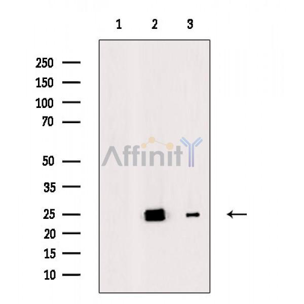 Валидация Affinity AF6751 - 3997