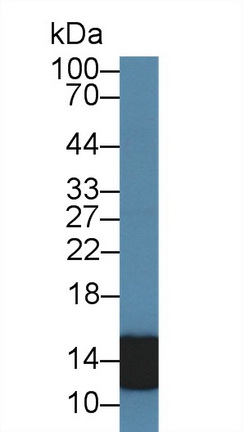 14523