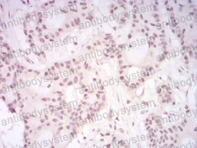 Валидация AntibodySystem RHG65802