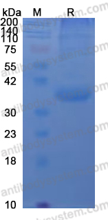 YVV09701, SDS-PAGE