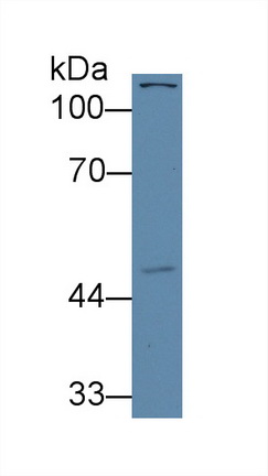 12585