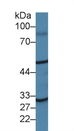 14456