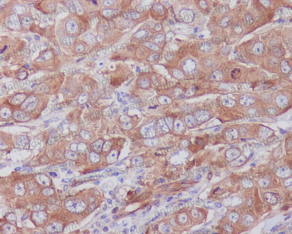 Валидация AntibodySystem RHE62401 (2246)