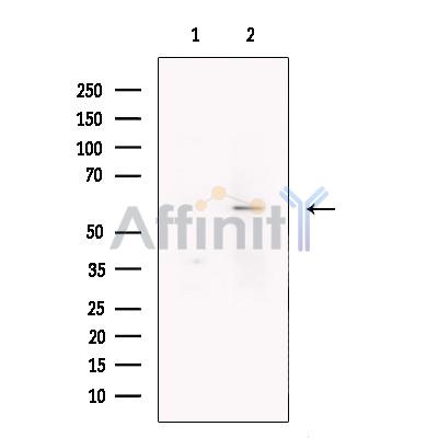 Валидация Affinity DF13401 - 8676