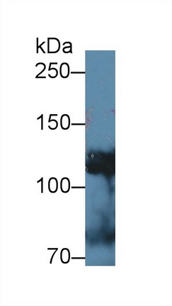 12612