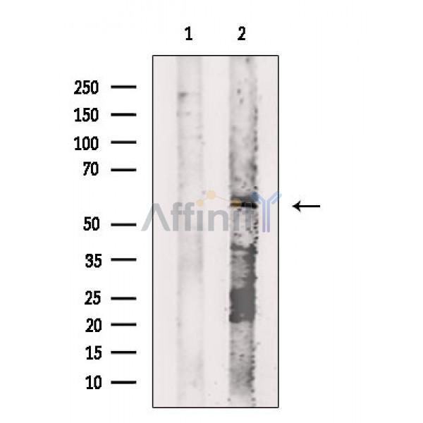 Валидация Affinity DF2287 - 12843
