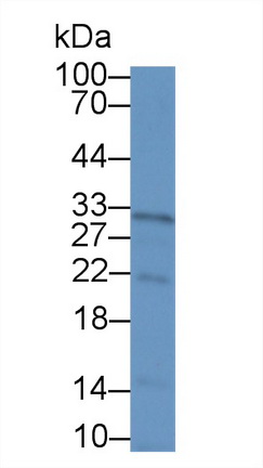 14141
