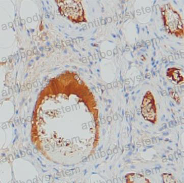 Валидация AntibodySystem RHC14302