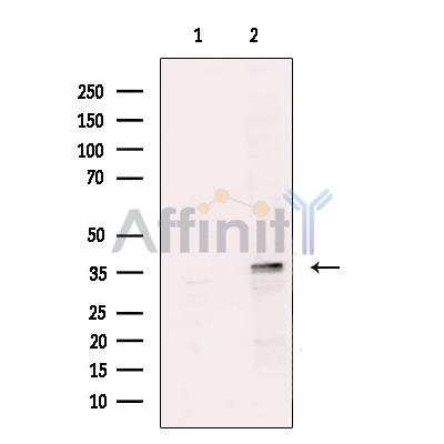 Валидация Affinity DF13574 - 9038