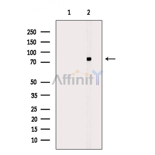 Валидация Affinity DF6881 - 18472