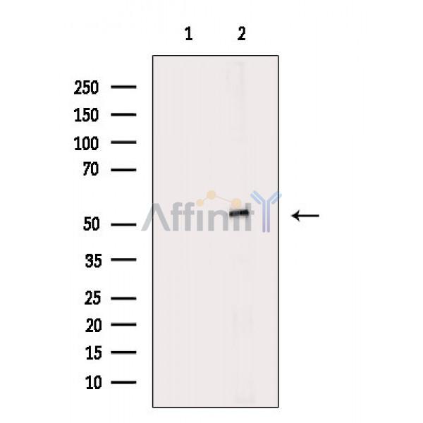 Валидация Affinity DF9013 - 21231