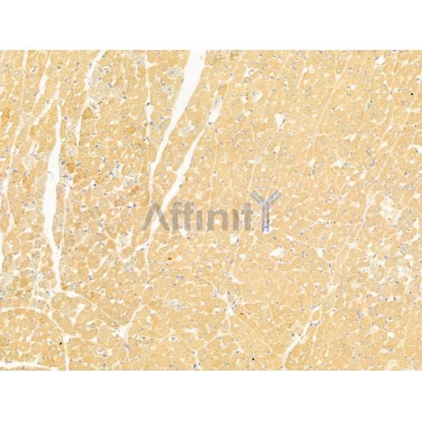 Валидация Affinity DF12215 - 6487