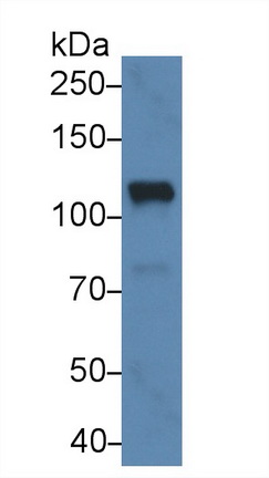 25218