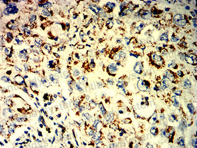 Валидация AntibodySystem RHD96801 (1885)