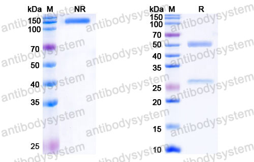 Валидация SDS-PAGE - AntibodySystem FHK17610