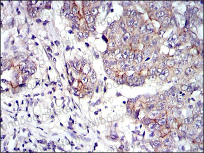 Валидация AntibodySystem RHD07802