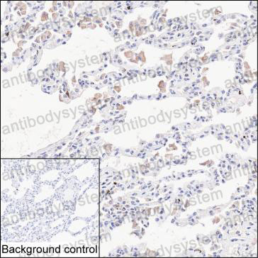 Валидация AntibodySystem RHJ84802