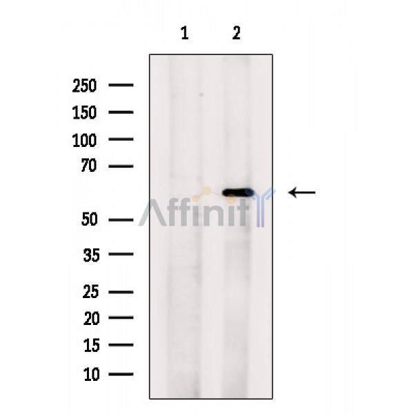 Валидация Affinity DF3547 - 14498