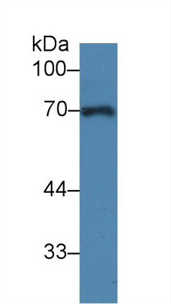 14263