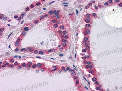 Валидация AntibodySystem RHC28601