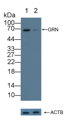 12215