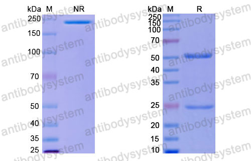 Валидация SDS-PAGE - AntibodySystem RHJ92825