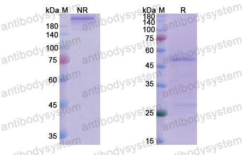 Валидация SDS-PAGE - AntibodySystem DHE09501